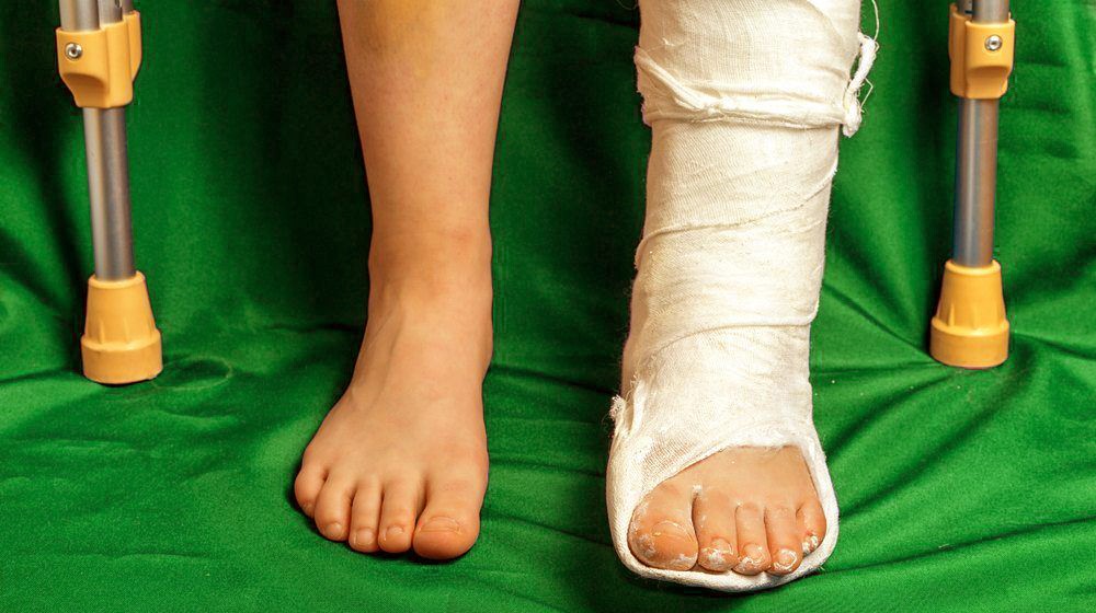 Splint cast for fracture treatment