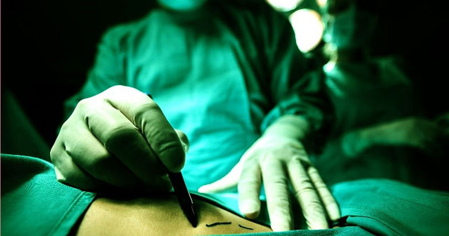Surgery for fracture treatment