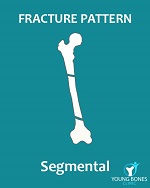 A segmental fracture​