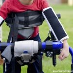 Spastic Cerebral Palsy – How Botox Injections Can Help Your Child?
