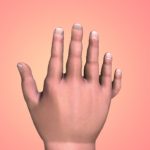 Pediatric Hand Disorders- All you need to know