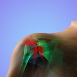 Frozen Shoulder- Try these Exercises for Relief