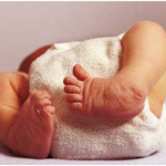 Introduction to Arthrogryposis