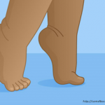 Toe walking in children – When should a parent start worrying
