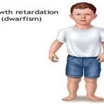Know all about Short stature/Little people of the world